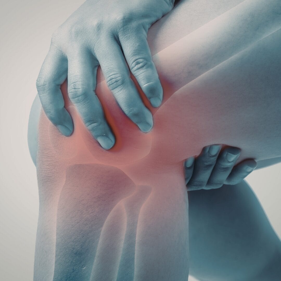 Knee Replacement Surgery Cost in Hyderabad - Pure Ortho Hospitals