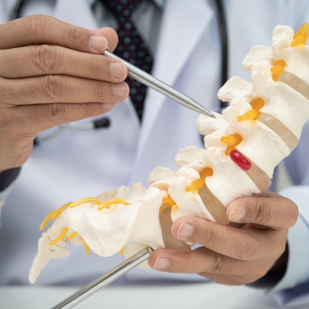 Endoscopic Spine Surgery in Hyderabad - Pure Ortho Hospitals Sainikpuri