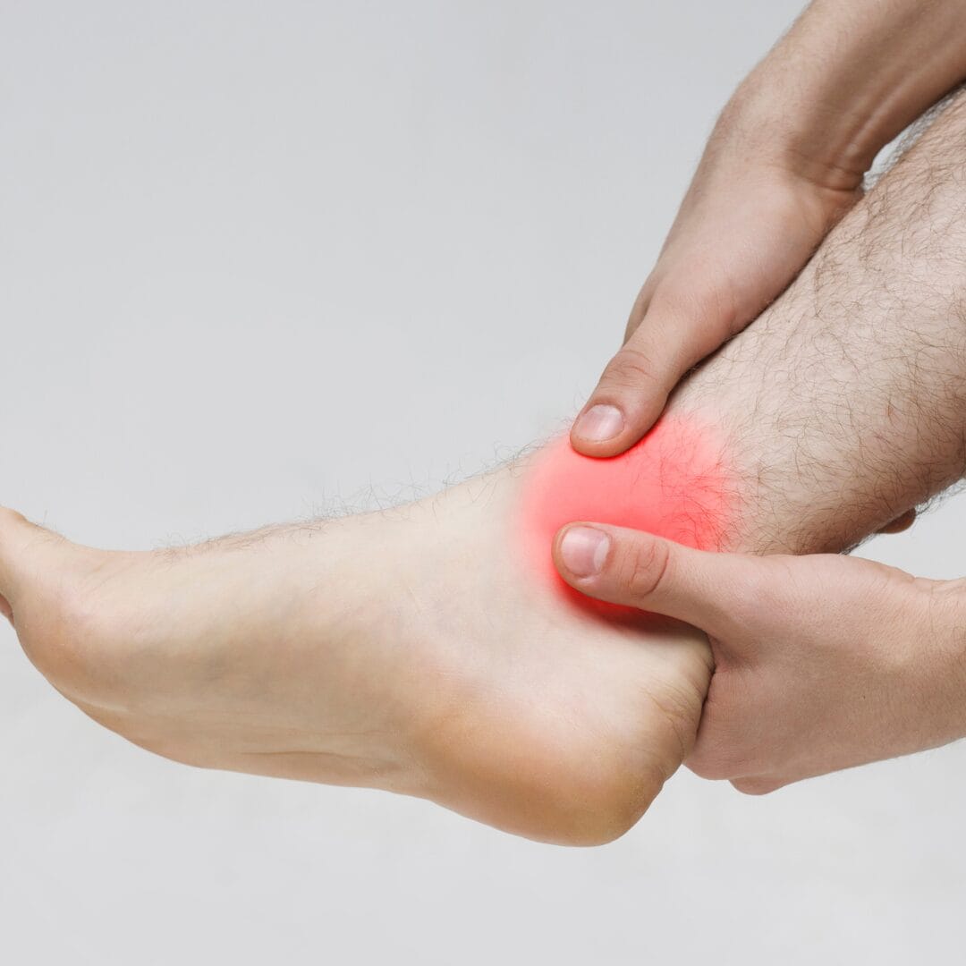 Ankle injury - fracture or sprain - Pure Ortho Hospitals Hyderabad