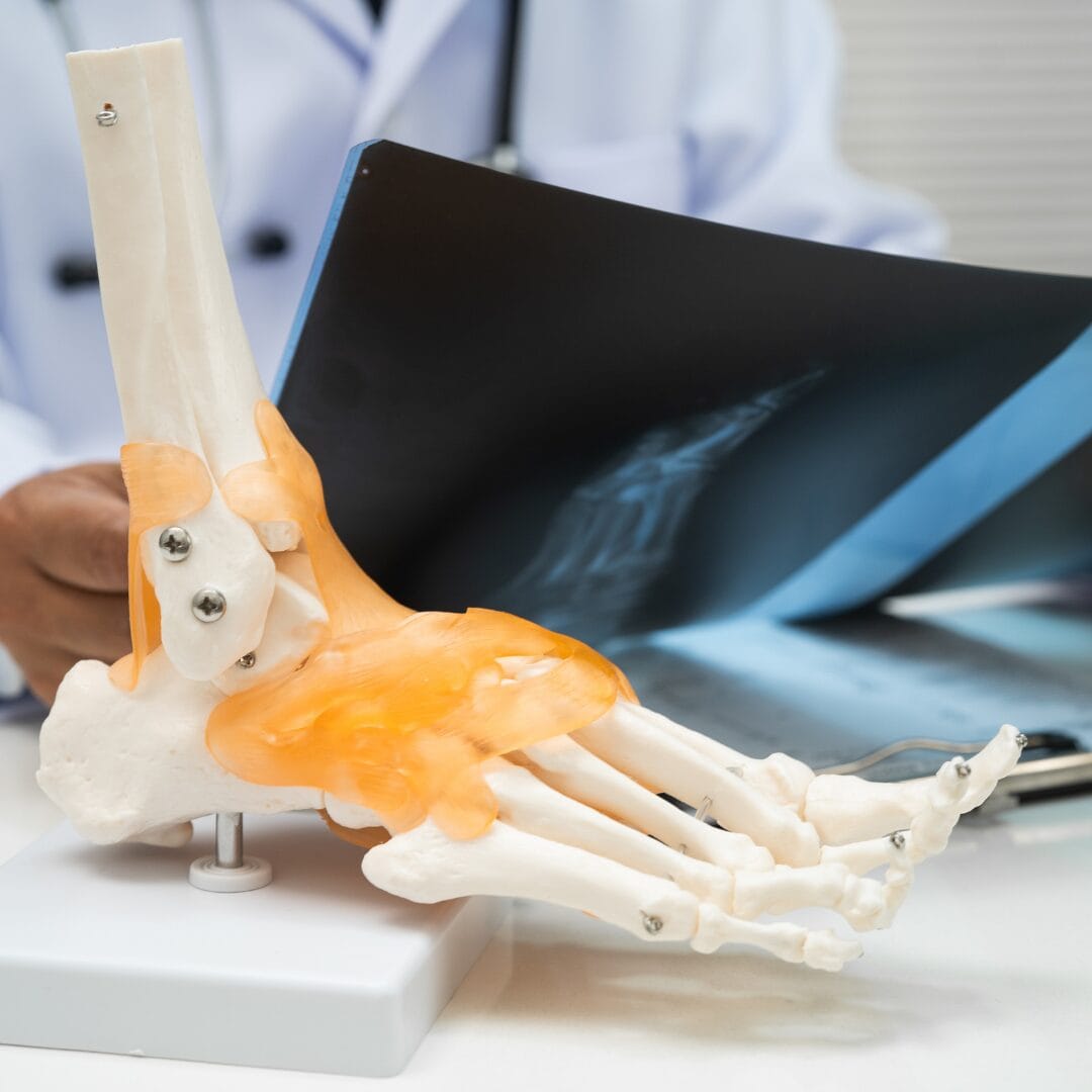 X-ray imaging for fracture diagnosis at Pure Ortho Hospitals Sainikpuri