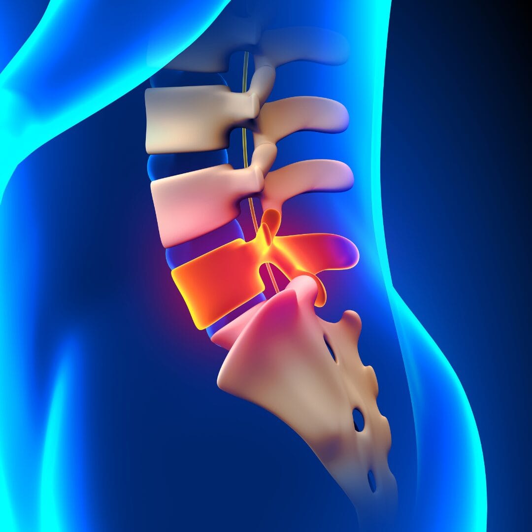 Spine damage from prolonged sitting - Pure Ortho Hospitals Sainikpuri Hyderabad