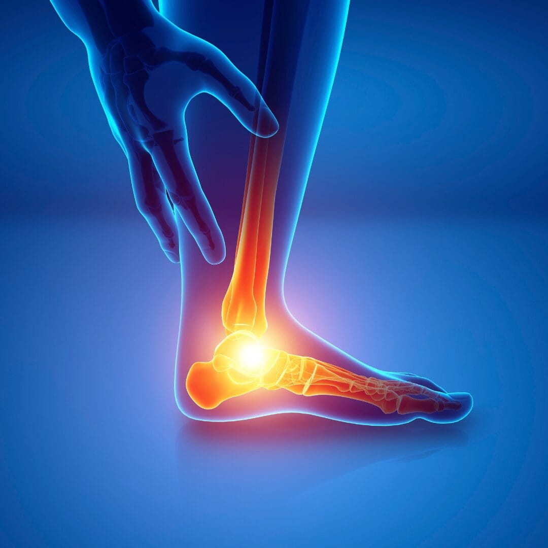 Heel pain morning plantar fasciitis treatment - Pure Ortho Hospitals Hyderabad