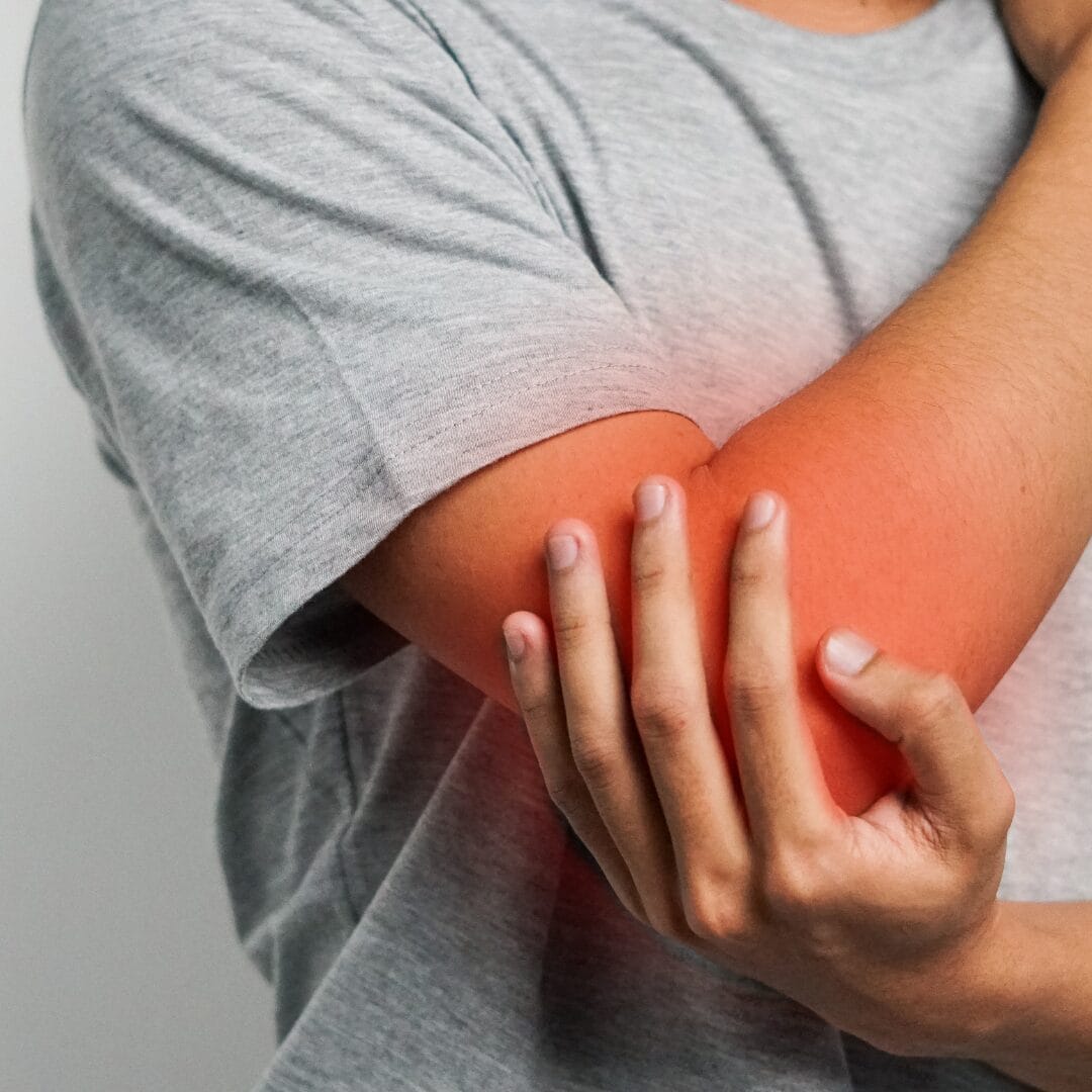 Tennis elbow lateral epicondylitis treatment Pure Ortho Hospitals Sainikpuri Hyderabad