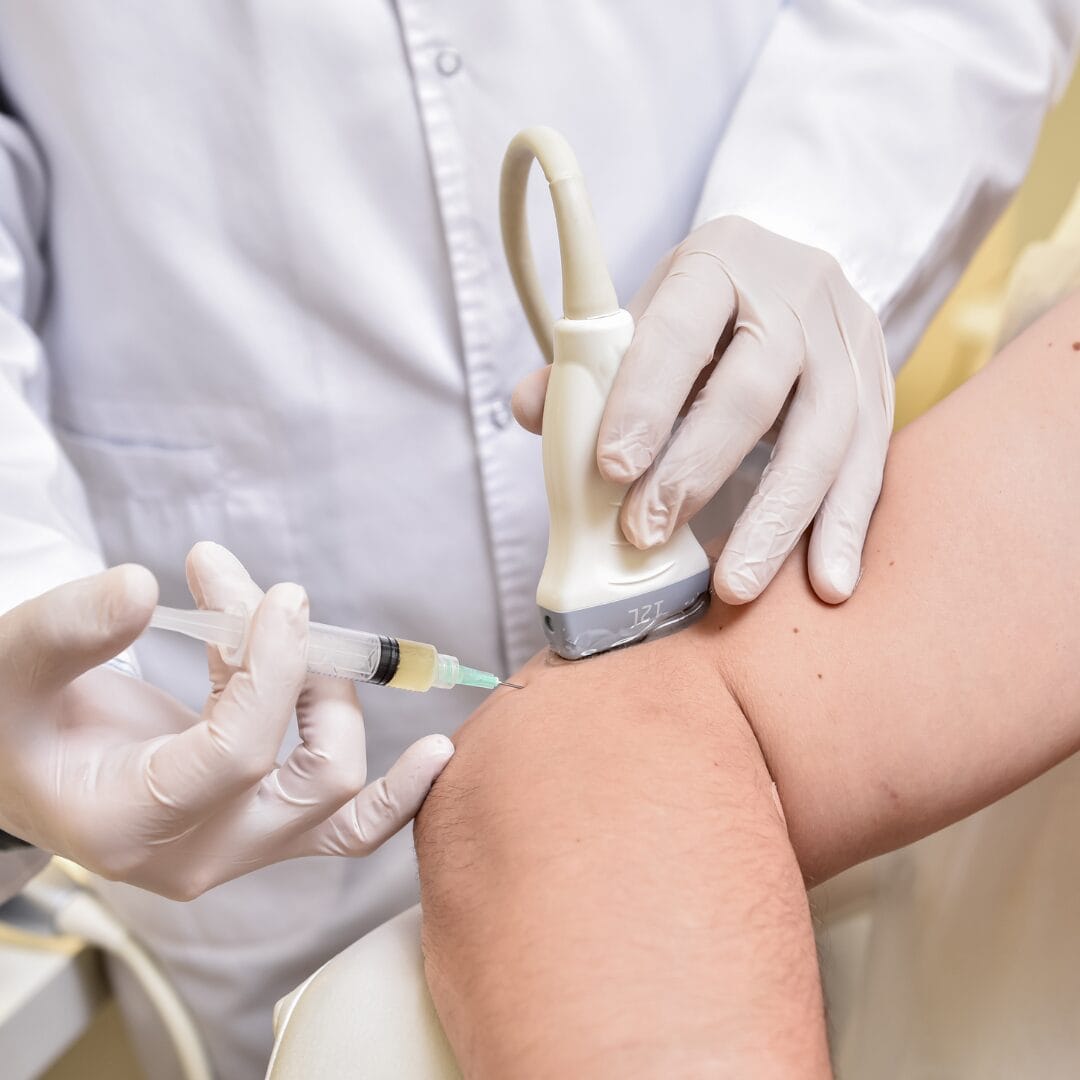 PRP injection tennis elbow ultrasound guided Pure Ortho Hospitals Hyderabad