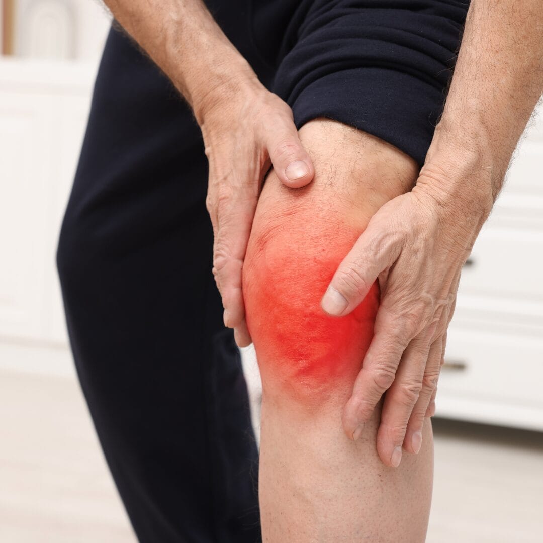 Knee pain arthritis monsoon rain season treatment Hyderabad Pure Ortho Hospitals