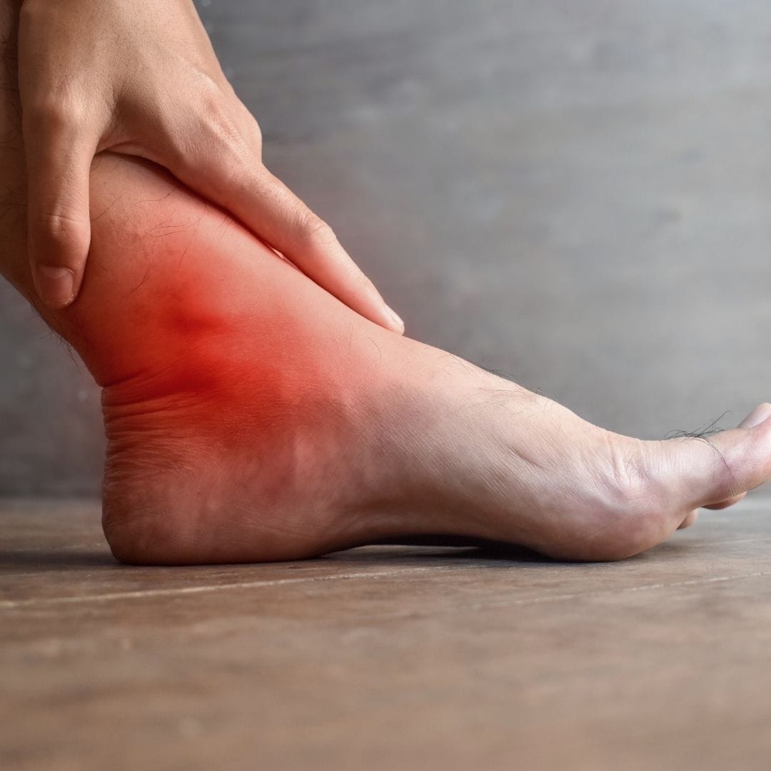 Ankle sprain treatment recovery Pure Ortho Hospitals Sainikpuri Hyderabad
