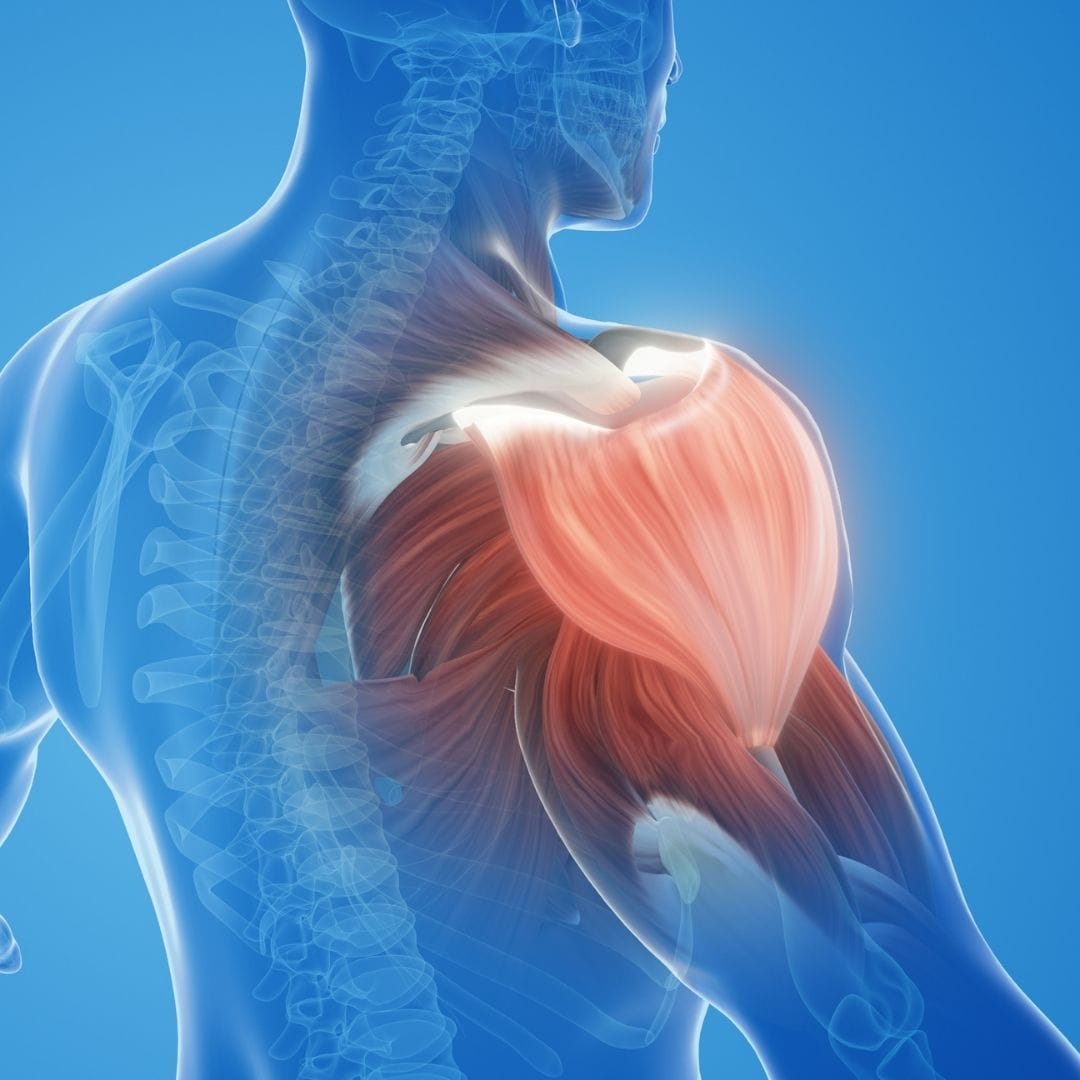 Shoulder dislocation treatment Bankart repair Pure Ortho Hospitals Sainikpuri Hyderabad