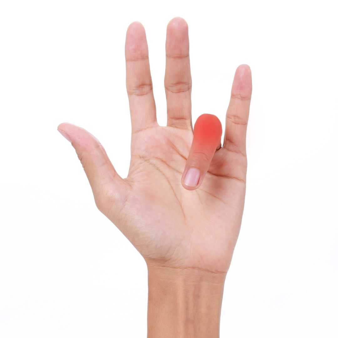 Trigger finger locked clicking treatment Pure Ortho Hospitals Sainikpuri Hyderabad