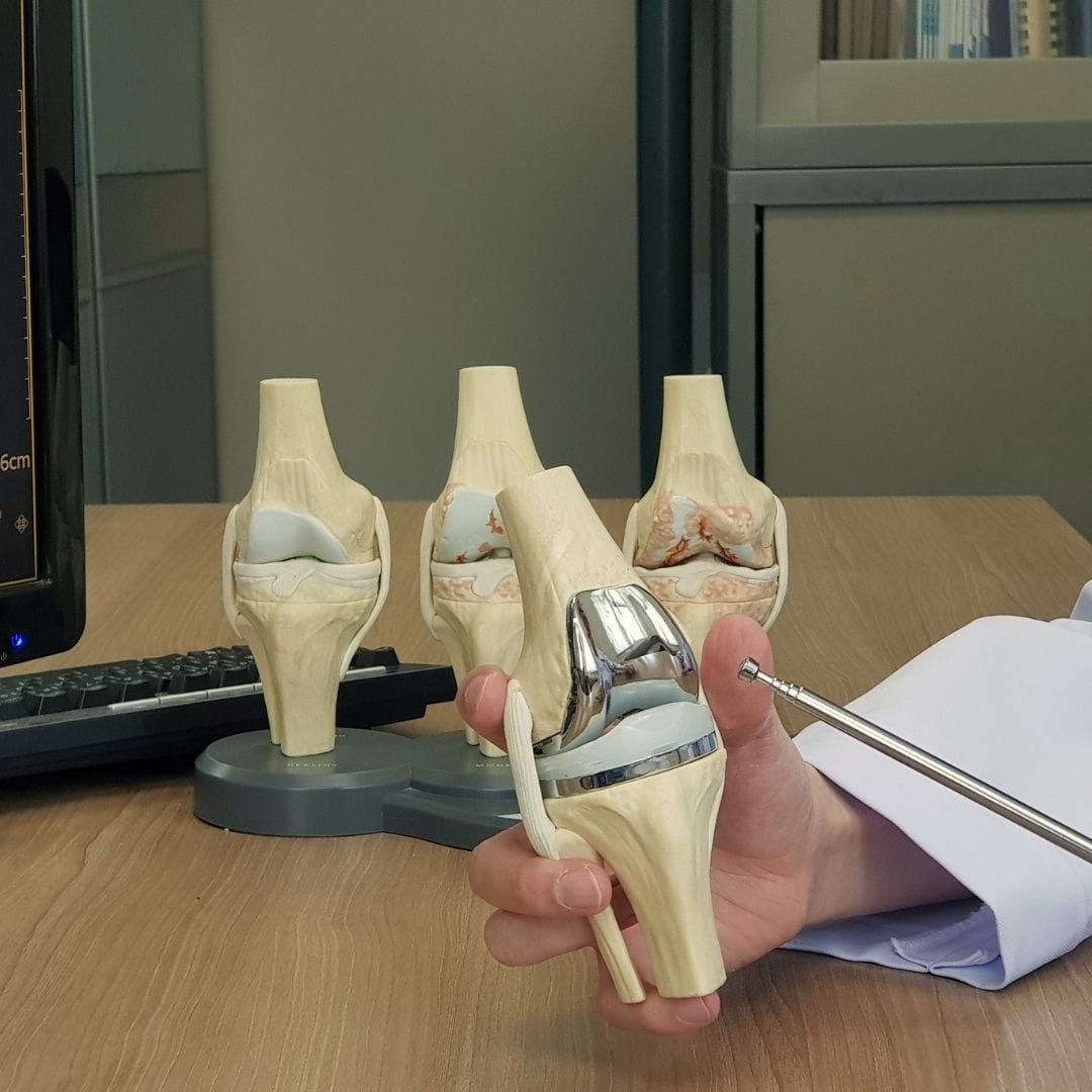Knee replacement surgery implant Pure Ortho Hospitals Hyderabad Sainikpuri