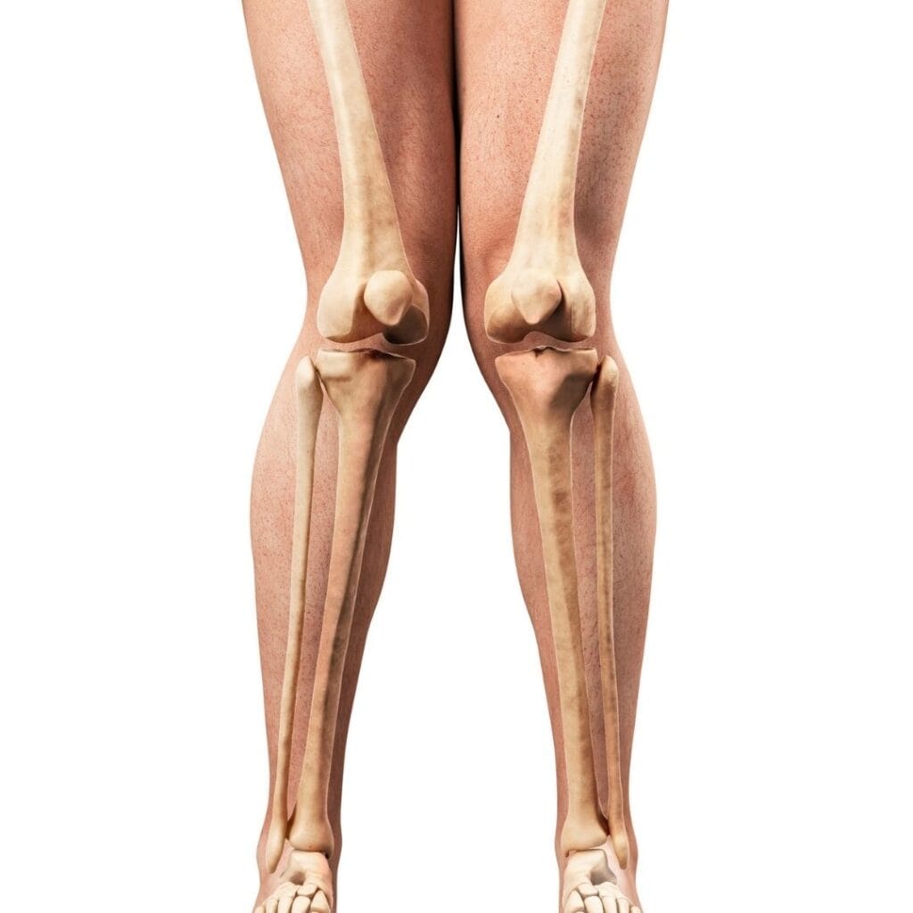 knock-knees-treatment