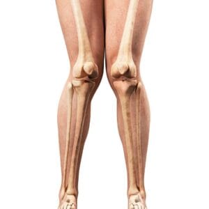 knock-knees-treatment