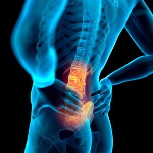 tailbone-coccyx-pain-1